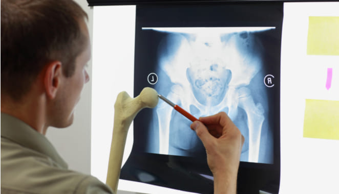 La osteoinmunología podría ayudar a pacientes con enfermedades reumáticas