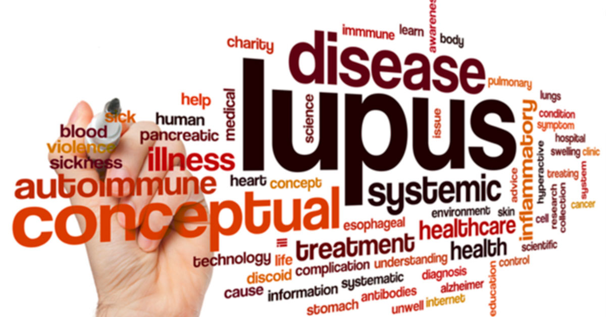 Tratamiento para lupus eritematoso sistémico ante el coronavirus