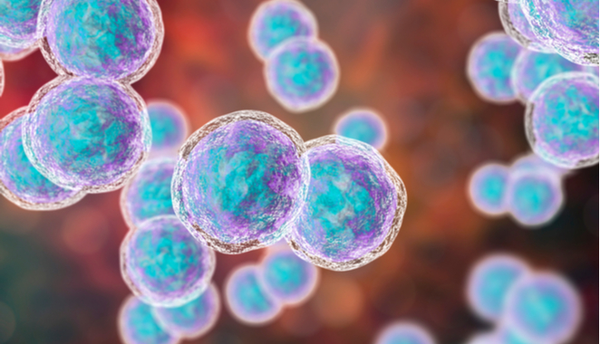 Artritis séptica y la infección en las articulaciones