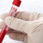 Velocidad de sedimentación prueba que ayuda a diagnosticar enfermedades inflamatorias o musculares