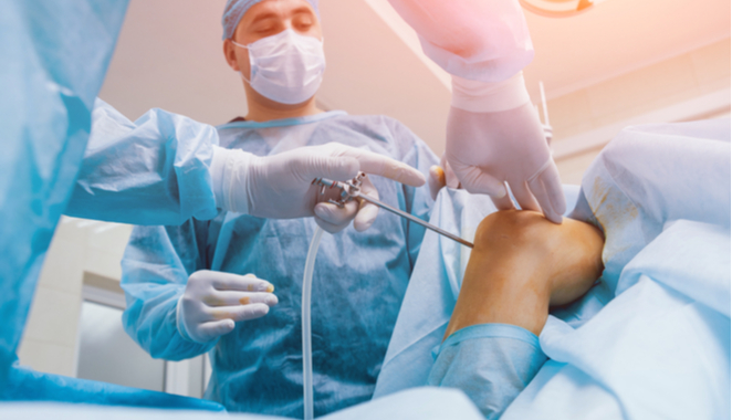 Artroscopia: operación para las articulaciones