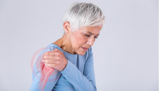 Sufrir de hombro congelado puede hacer que desarrolle artrosis