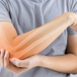 Dr. Anaya: “Pacientes con artritis reumatoide pueden desarrollar poliautoinmunidad”