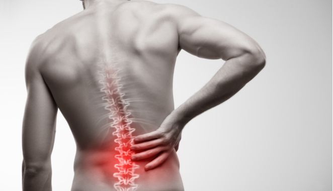 Cuándo hay que operar en caso de dolor de espalda