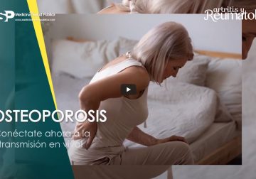 Detecte a tiempo signos de osteoporosis